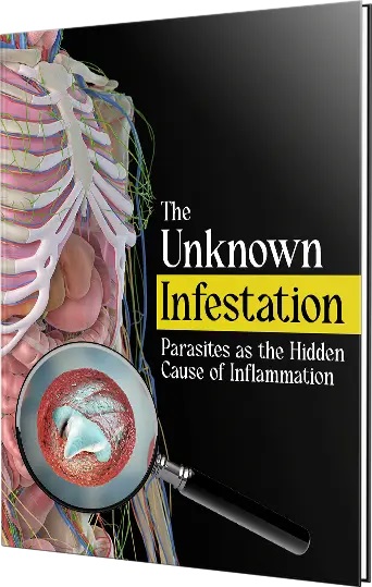 The Unknown Infestation: Parasites as the Hidden Cause of Inflammation